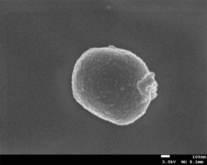 汽水・海水環境下で土壌・地下水を浄化できるデハロゲニモナス属細菌の単離...