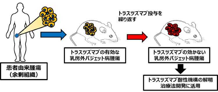 外陰部皮膚がんの薬剤耐性の仕組みを解明?治療開発への貢献に期待? | ...
